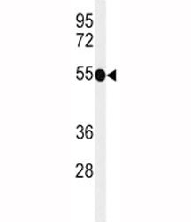 Western blot analysis of CD30 antibody and mouse liver tissue lysate. Predicted molecular weight: 53