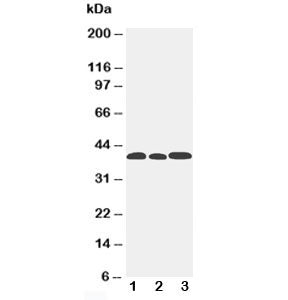 Western blot testing of CCR5 antibody and Lane 1: mouse lung; 2: mouse intestine; 3: mouse kidney. P