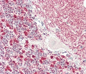 IHC testing of FFPE human cerebellum tissue with Kinesin light chain 1 antibody. HIER: steam section