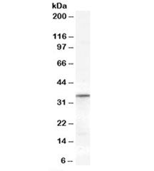 VDAC2 Antibody