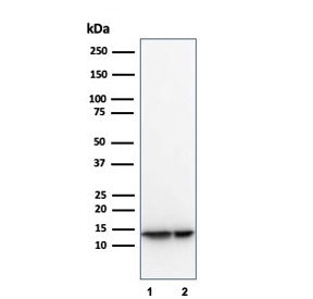 MIF Antibody / Macrophage Migration Inhibitory Factor