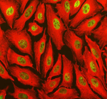 Immunofluorescent staining of TOPBP1 using anti-TOPBP1 antibody (green) and anti-Beta Tubulin antibo