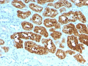 Retinol Binding Protein 4 Antibody / RBP4