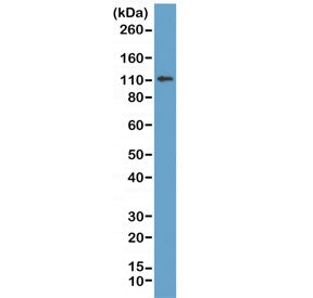 Western blot of human MCF7 lysate using recombinant E-Cadherin antibody at 1:1000. Expected molecula