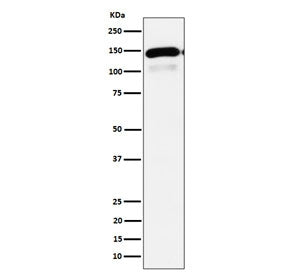 Western blot testing of human HepG2 cell lysate with Phospholipase C-beta-1 antibody. Predicted mole