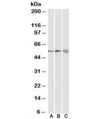 Western blot testing of human [A], mouse [B] and rat [C] heart lysates with ATP5B antibody at 0.3ug/