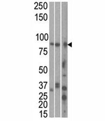 The MARK1 antibody used in western blot to detect MARK1 in HeLa, T47D, and mouse brain cell line/ ti