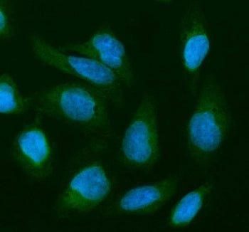 Cofilin 2 Antibody / CFL2