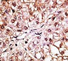 BNIP3L Antibody