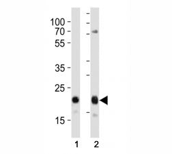 Western blot analysis of lysate from (1) HeLa and (2) MCF-7 cell line using CD9 antibody at 1:1000. 