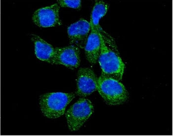 RASGAP Antibody / RASA1