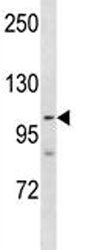 PARP1 Antibody, 0.08ml