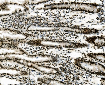 IHC staining of FFPE mouse intestine with Vinexin antibody. HIER: boil tissue sections in pH8 EDTA f