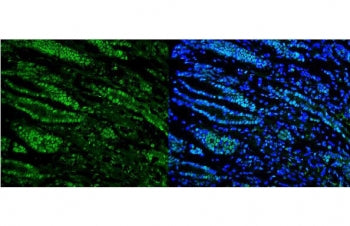 DHX9 Antibody / RNA Helicase A