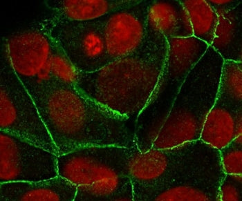 Immunofluorescent staining of human MCF7 cells with E-Cadherin antibody (clone ECD1-2, green) and Re
