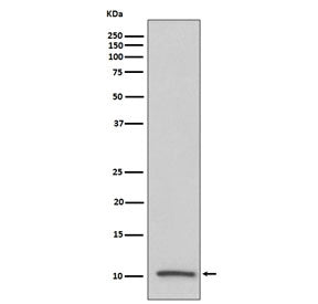 Western blot testing of human serum lysate with IGF2 antibody. Circulating IGF2 has an observed mole