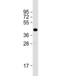 Western blot testing of human skeletal muscle lysate with TMEM115 antibody at 1:2000. Predicted mole