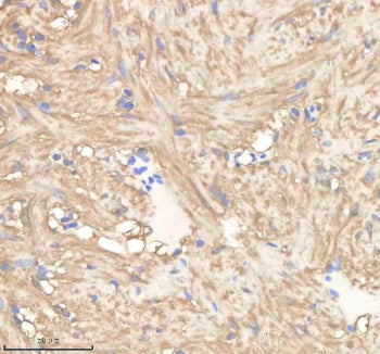 IHC staining of zebrafish Pgam1a/b protein using Zebrafish Pgam1 antibody, HRP-labeled secondary and
