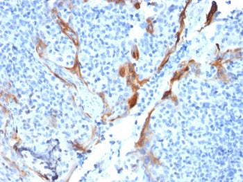 IHC testing of FFPE human tonsil with Cytokeratin 16 antibody (clone KRT16/1714). Required HIER: boi