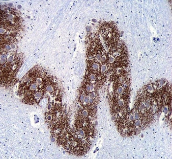 IHC testing of FFPE human brain tissue with Synaptophysin antibody. HIER: steam section in pH6 citra