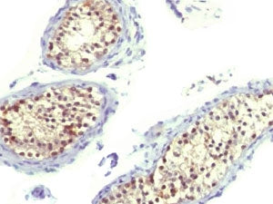 Thymidylate Synthase Antibody