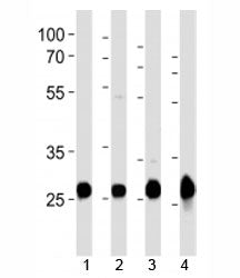 Sdhb Antibody