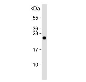 Western blot testing of human heart tissue lysate with CLDN2 antibody. Predicted molecular weight ~2