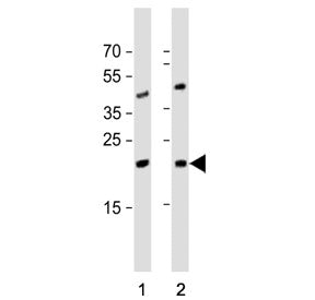 Western blot testing of 1) human Jurkat and 2) mouse testis tissue lysate with ORMDL3 antibody. Pred