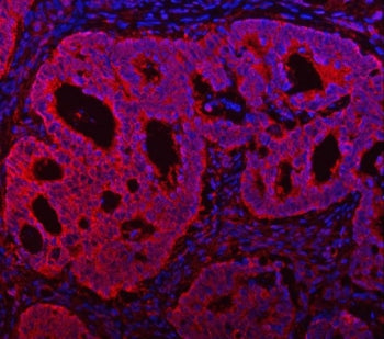 TMC7 Antibody / Transmembrane channel-like protein 7