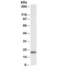 Western blot testing of mouse heart lysate with Wfdc1 antibody at 0.3ug/ml. Predicted molecular weig