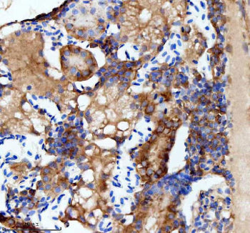 IHC staining of zebrafish Flt1 protein using Zebrafish Flt1 antibody, HRP-labeled secondary and DAB 