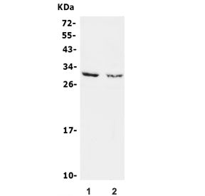 Western blot testing of 1) rat brain and 2) mouse brain lysate with Calbindin 2 antibody. Expected m