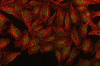 Immunofluorescent staining of FFPE human U-2 OS cells with MED26 antibody (green) and Beta Tubulin m