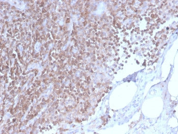 IHC staining of FFPE human lymph node with CD3e antibody (clone C3e/2858R). HIER: boil tissue sectio