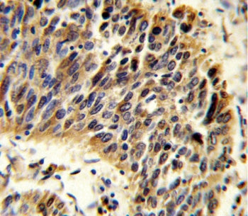 Vitronectin Antibody / VTN