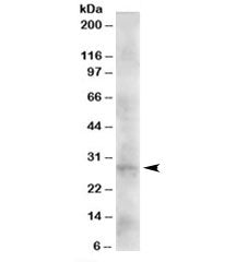 Western blot testing of human heart lysate with DKK2 antibody at 2ug/ml. Expected molecular weight: 