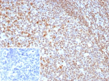 MGMT Antibody
