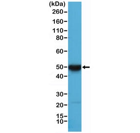 Western blot testing of human HeLa cell lysate with recombinant Cytokeratin 17 antibody at 1:10,000 