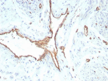 IHC staining of FFPE human uterus tissue with recombinant PECAM1 antibody (clone rPECAM1/8829). HIER