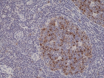 IHC testing of FFPE human tonsil tissue with recombinant Aurora B antibody at 1:1000.