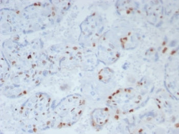 IHC staining of FFPE human placenta. Strong nuclear staining using KIP2/8169R at 2ug/ml. HIER: boil 
