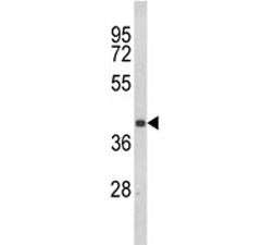 CCR3 Antibody