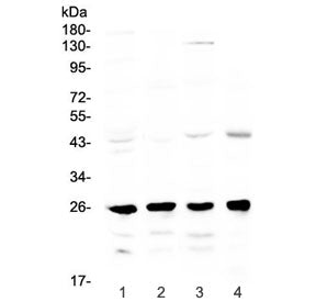 Western blot testing of 1) rat brain, 2) rat lung, 3) mouse stomach and 4) mouse kidney lysate with 
