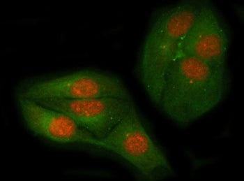 Immunofluorescent staining of FFPE human HeLa cells with c-Myc antibody (red) and Beta Tubulin mAb (