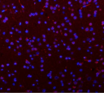 Immunofluorescent staining of FFPE rat brain tissue with Phosphoglucomutase 3 antibody (red) and DAP