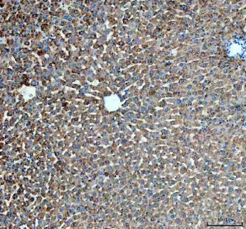 IHC staining of FFPE rat liver tissue with PYGL antibody. HIER: boil tissue sections in pH8 EDTA for