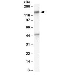 Western blot testing of human brain lysate with Patched antibody at 1ug/ml. Predicted molecular weig