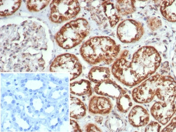 IHC staining of FFPE human kidney tissue with MR1 antibody (clone MR1/7579). Inset: PBS used in plac