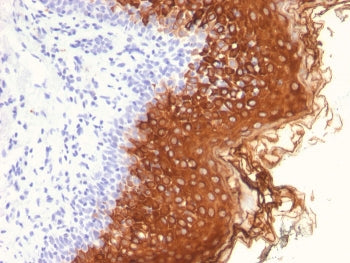 IHC staining of FFPE human skin with Cytokeratin 10 antibody (clone AE20). HIER: boil tissue section