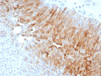 Uroplakin 1A Antibody / UPK1A